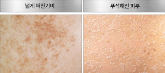มาส์กหน้า Medi Peel Melanon-X Dark Spot Ampoule Mask 1 แผ่น