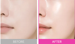 มาส์กเจล Celderma Daily Hyaluronic Acid Essence ขนาด 29 กรัม